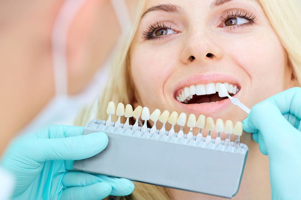 porcelain veneers benefits Lansdale Pennsylvania