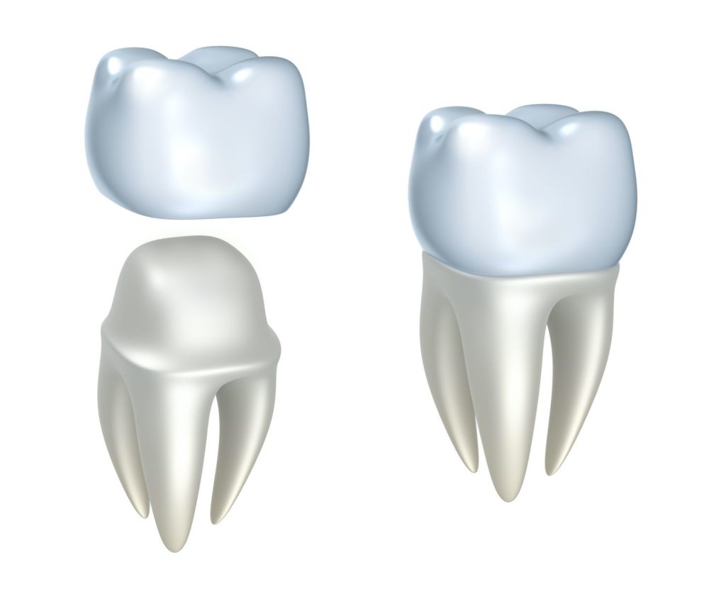 dental crown benefits Lansdale Pennsylvania
