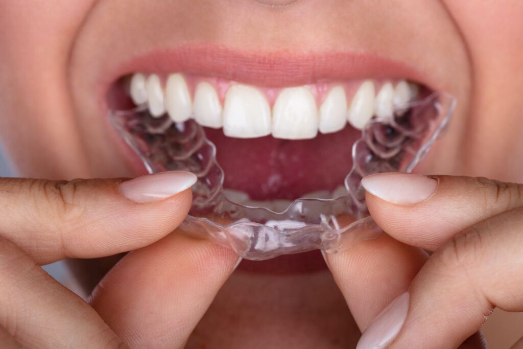 Invisalign and Your Diet