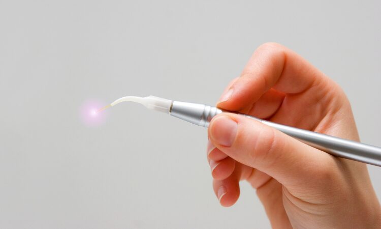 Laser dentistry emerges as a modern alternative for gum disease treatment, offering precise and less painful treatment options.